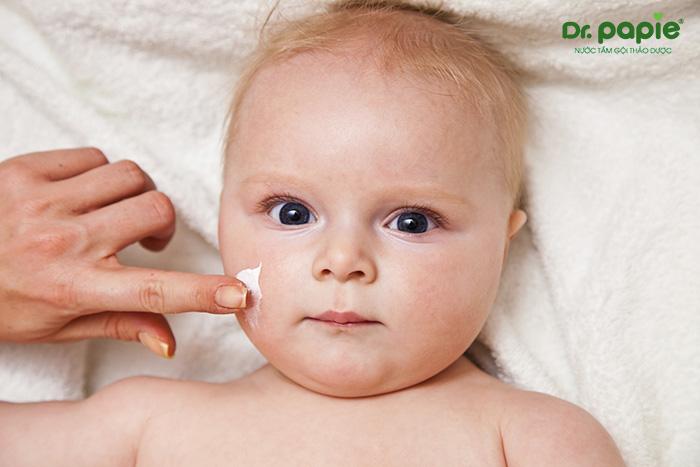 Cách ngăn ngừa bé bị chàm sữa ở mặt