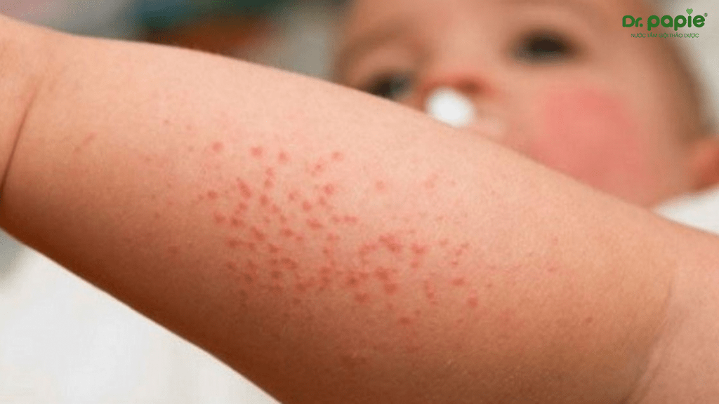 nước tắm trị rôm sảy cho bé